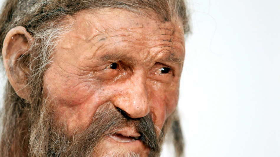 Iceman Oetzi was balding, darker-skinned than thought: study