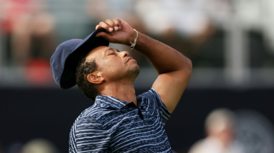 Tiger limps to 74 at PGA due to sore leg, poor irons